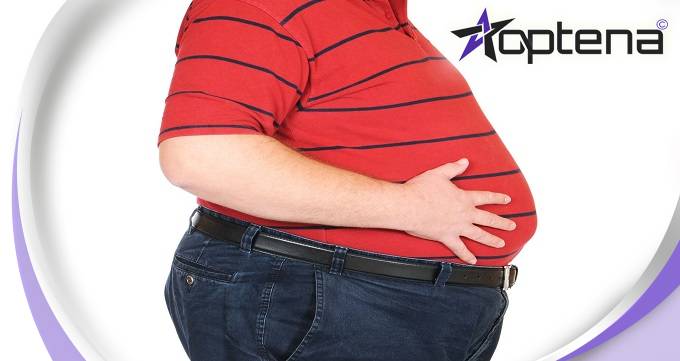 علل چاقی چیست؟