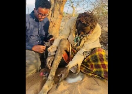 آزادی مرد سومالیایی از سحر و جادوی عجیب ۱۵ ساله+ فیلم