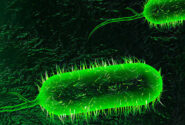 یک مورد ابتلا به بیماری وبا در سقز شناسایی شد